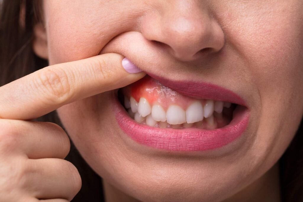 Signs That Point to Periodontal Care