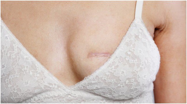 Recovery And Follow-Up Care