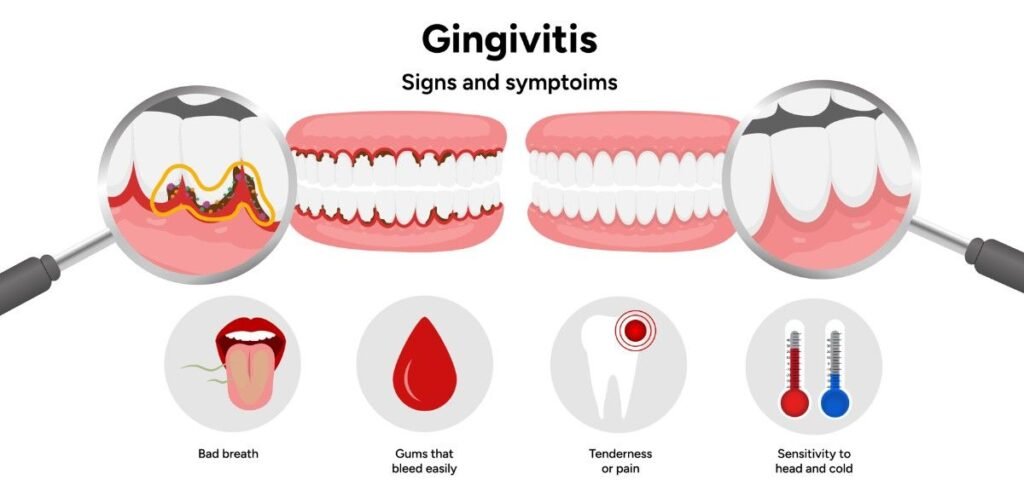 Gum Disease and Inflammation