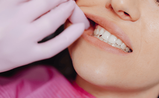 Initial Assessment and Smile Evaluation