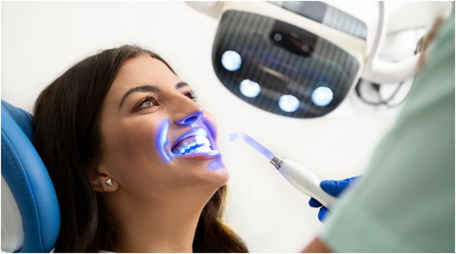 Why People in Edmonton Choose Professional Teeth Whitening for Smile Enhancement