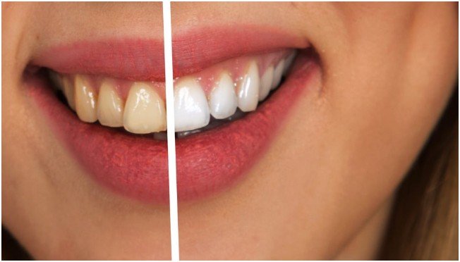 A Brighter Smile With Expert Care