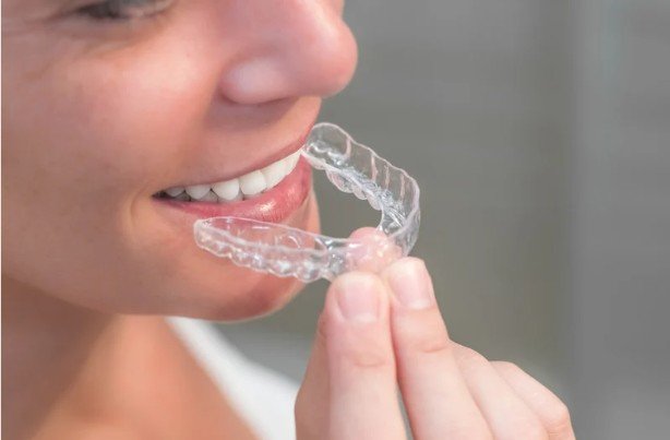 Why Orthodontic Relapse Happens and How to Prevent It