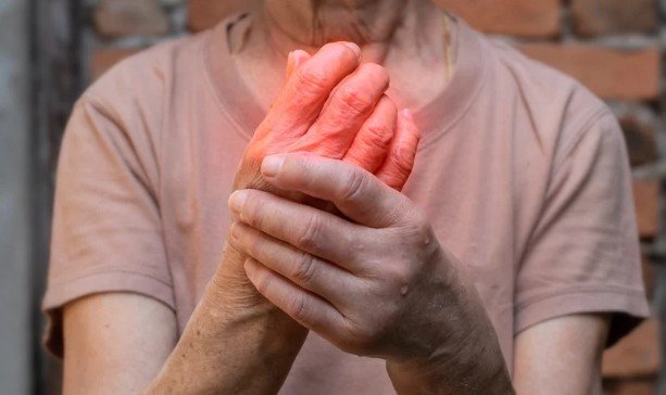 Managing Rheumatic Flares: Fast-Acting Strategies to Reduce Joint Inflammation