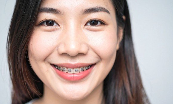 SuperSmile Orthodontics (Centennial, Las Vegas)